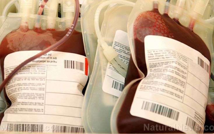 Switzerland To Provide Patients With ‘Safe Blood Transfusions’ From Unvaccinated Purebloods - News Punch