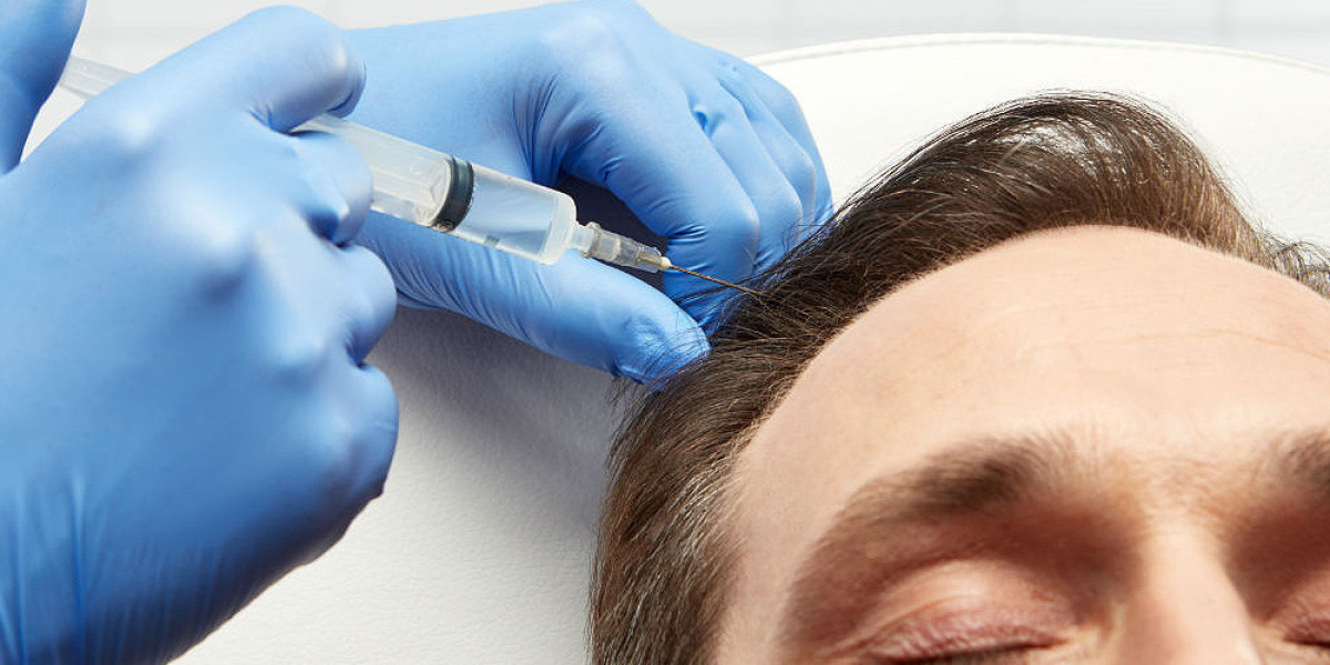 PRP Treatment: A Natural Approach To Hair Restoration And Rejuvenation