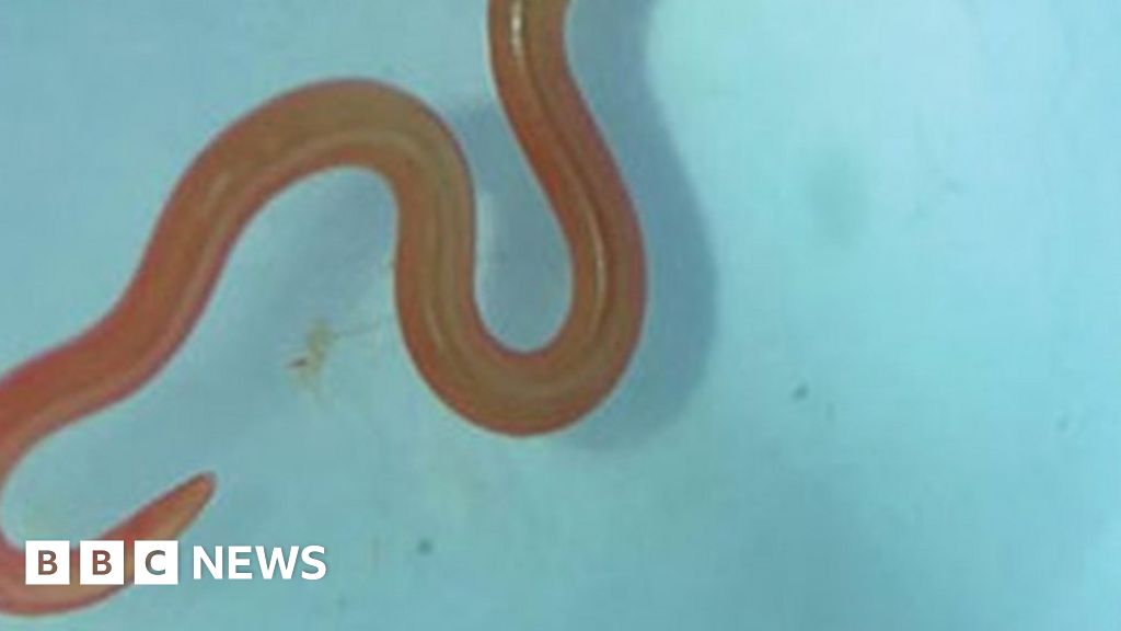 Live worm found in Australian woman's brain in world first - BBC News