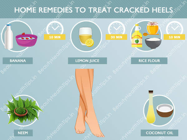 Treating cracked feet, the 5 best excellent home solutions - Care Beauty