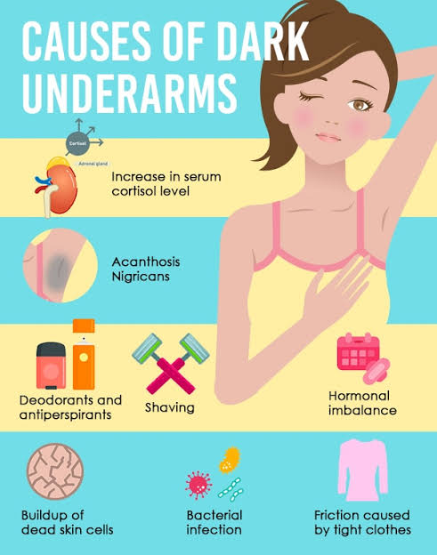 Home remedies to lighten dark underarms - Care Beauty