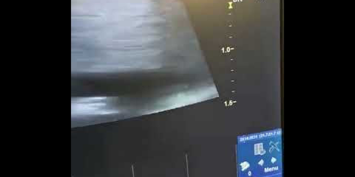 Liver Shunts in Dogs: Causes, Symptoms & Treatment