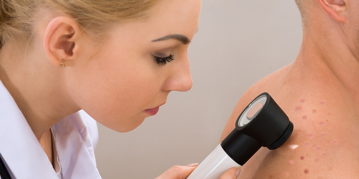 Skin Cancer Treatment Market Trends, Size, Segments, Industry Growth and Forecast to 2030