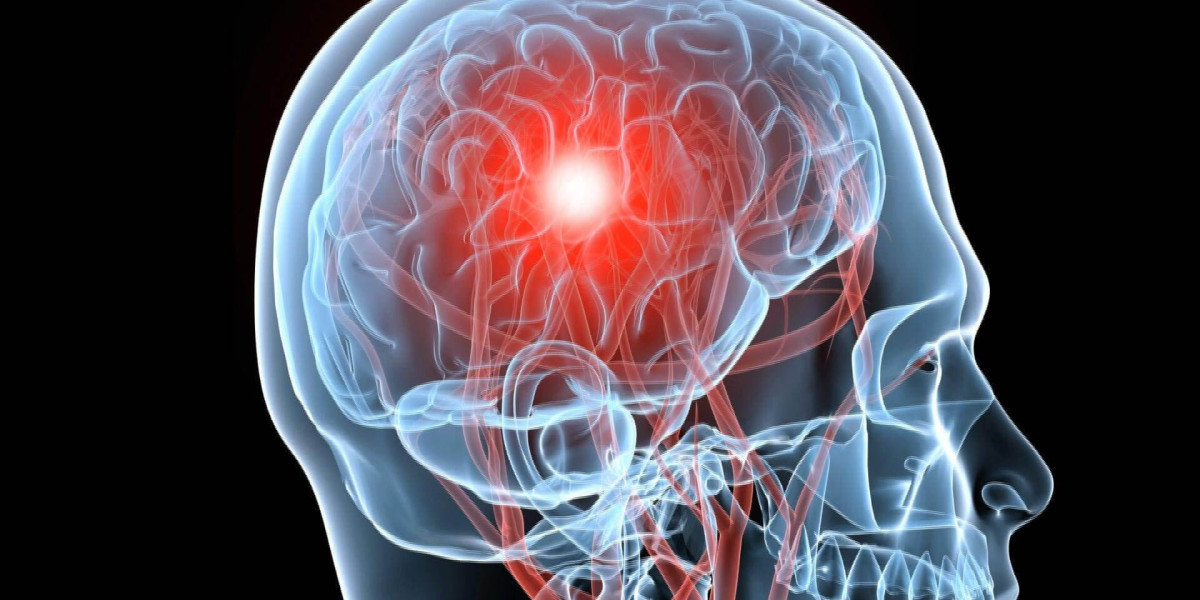 Traumatic Brain Injury Diagnostics Equipment Market Key Highlights and Future Opportunities till 2030