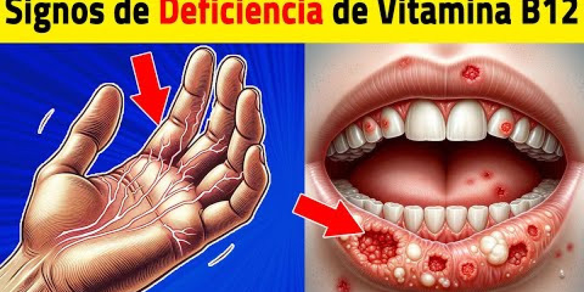 Gelatina: beneficios de un postre saludable rico en proteínas