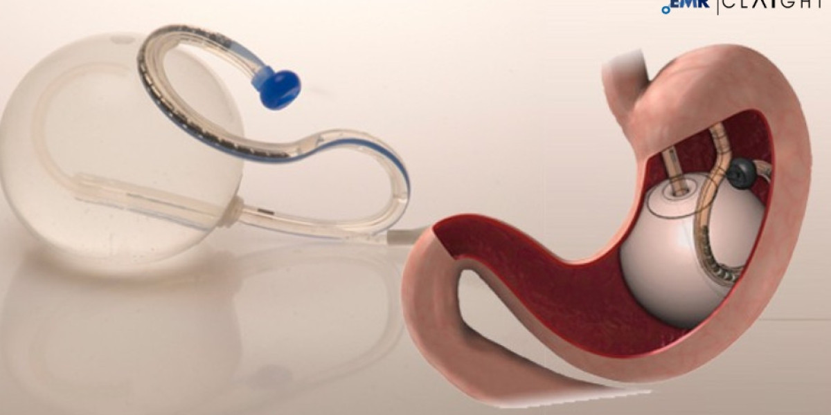Europe Balloon Catheters Market Size, Share, Growth, Trends, & Key Players | 2024-2032