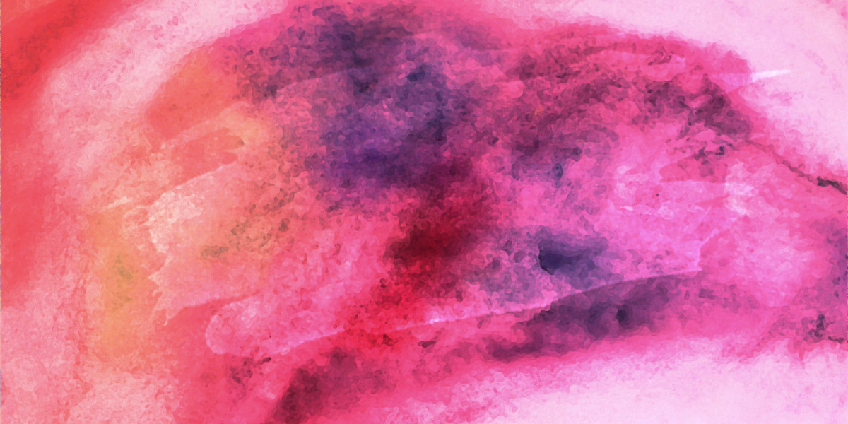 Erectile Dysfunction Treatment Pills: Understanding Your Options